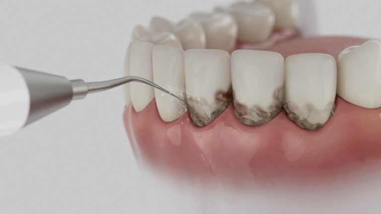 Reliable Teeth Cleaning And Checkup contractor in Slidell, LA by Smile Center Dentistry